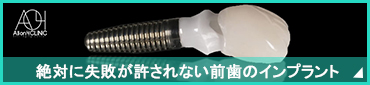 前歯のインプラント名医｜銀座の失敗しないインプラント。成功率99.9%